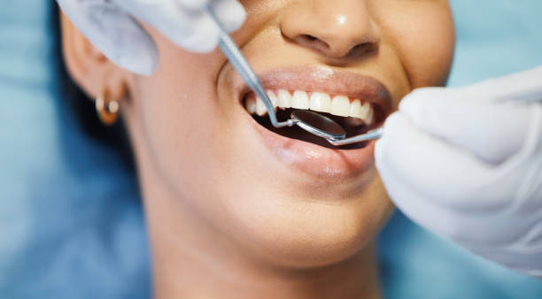 Best Emergency Dentist for Lost Fillings or Crowns in Kane, PA